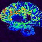 BioDynaMo: Newcastle helps develop program for simulating brain tumour growth